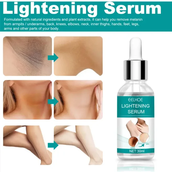 EELHOE Underarm Brightening Serum For Men And Women Underarm Whitening Serum - Image 1